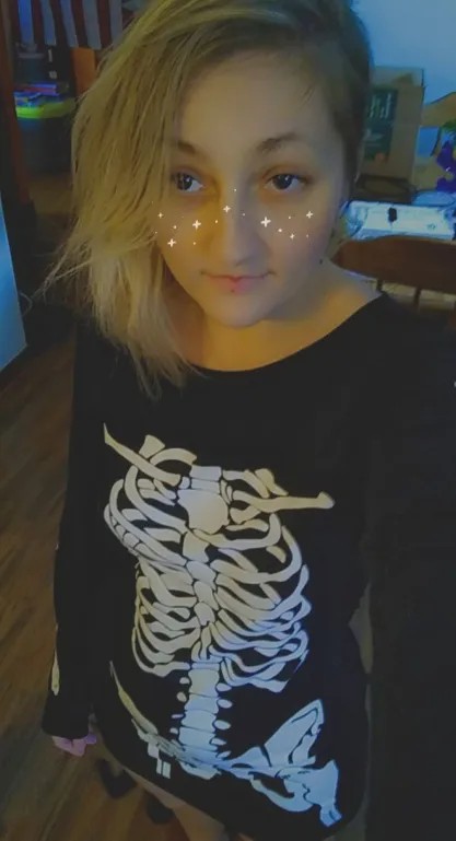 Stare